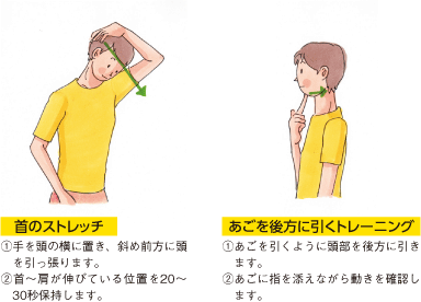 首のストレッチ

①手を頭の横に置き、斜め前方に頭を引っ張ります。
②首〜肩が伸びている位置を20〜30秒保持します。
あごを後方に引くトレーニング

①あごを引くように頭部を後方に引きます。
②あごに指を添えながら動きを確認します。
