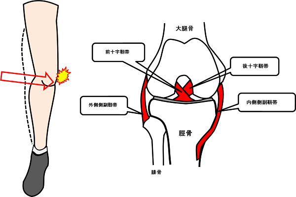 「内側側副靭帯損傷」の画像検索結果