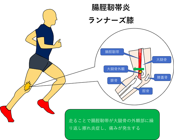 苅部俊二のダッシュ過去記事サムネイル